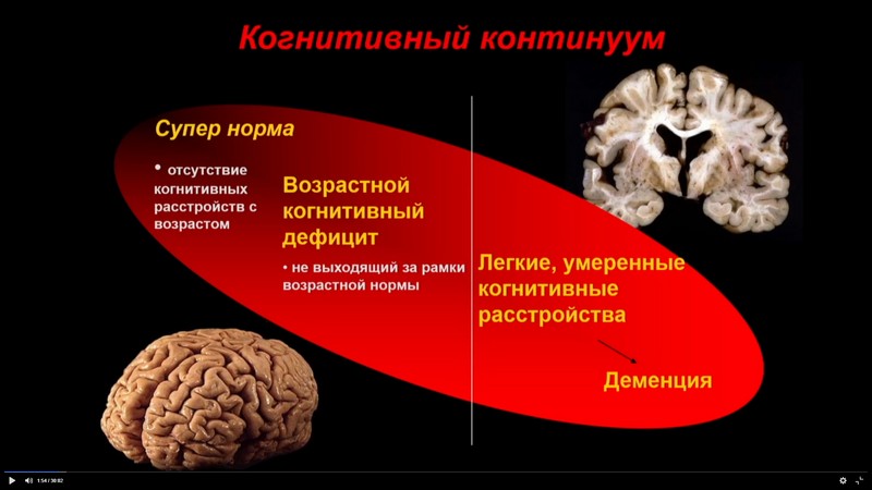 Рационалды терапияның негізі ретінде қатар жүретін науқастардағы когнитивті бұзылыстың патогенетикалық талдауы